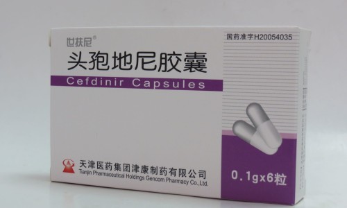 喜鹊屎掉在手臂上是喜事-喜鹊屎掉在身上好吗网 :分享喜鹊屎掉在手臂上是喜事-喜鹊粪便落在身上有什么寓意知识